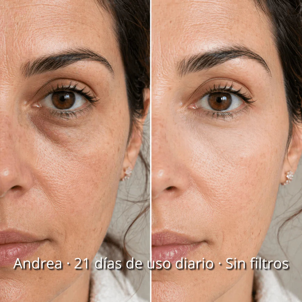 Novaglow™ – Adios a las ojeras sin cremas ni trucos